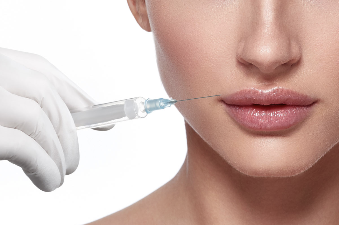 Trattamento filler labbra in ambito medico estetico